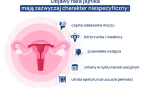 Niespecyficzne objawy raka jajnika: częste oddawanie moczu, ból brzucha, wzdęcia, zmiany cyklu, utrata apetytu.