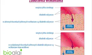 Objawy zaburzeń wchłaniania – jak rozpoznać i co może je powodować?