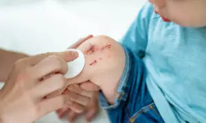 Dziecko z otartym kolanem, któremu przemywa się ranę. To przypomina, co to hemofilia i jak ważne jest dbanie o bezpieczeństwo.