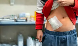 Dziecko z plastrem na brzuchu, odsłoniętym przez podwiniętą bluzę.