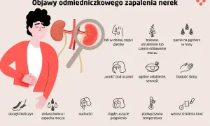 Ilustracja przedstawia objawy zapalenia nerek: ból pleców, problemy z oddawaniem moczu, obrzęki, nudności, gorączkę i inne.