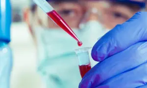 Jak długo jest ważne skierowanie do laboratorium? Uniknij problemów z ważnością