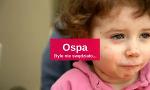 Jakie leki na ospę u dzieci? Skuteczne metody łagodzenia objawów