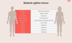 Tabela wyników badania ogólnego moczu. Wartości referencyjne dla azotynów w moczu: nieobecne.