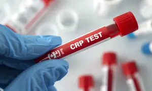 Rękawiczka trzyma probówkę z krwią do badania CRP. Cena tego testu jest kluczowa dla diagnostyki.