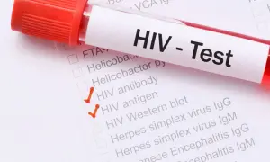 Próbówka z krwią do testu HIV. Zaznaczone pozycje "HIV antibody" i "HIV antigen" mogą być istotne w diagnostyce objawów u mężczyzn.