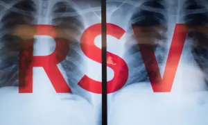 Rentgen klatki piersiowej z czerwonym napisem RSV.