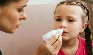 Mama delikatnie przykłada chusteczkę do nosa córki, która ma krew z nosa.