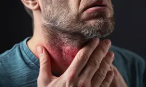 Mężczyzna dotyka zaczerwienionego gardła, co może wskazywać na paciorkowiec objawy.
