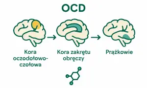 Ilustracja pokazuje mózg z zaznaczonymi obszarami: kora oczodołowo-czołowa, kora zakrętu obręczy i prążkowie. Sugeruje to powiązanie tych obszarów z objawami OCD.