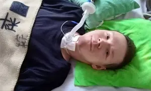Chłopiec leży w łóżku z rurką tracheostomijną i podłączonym respiratorem.