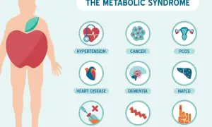 Ilustracja przedstawia sylwetkę człowieka z jabłkiem w brzuchu, symbolizującym zespół metaboliczny. Obok ikony wskazują na choroby: nadciśnienie, raka, PCOS, choroby serca, demencję, NAFLD, insulinooporność, problemy z lipidami i cukrzycę typu 2.