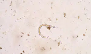 Mikroskopowy obraz nicienia w próbce, otoczony drobnymi cząstkami.