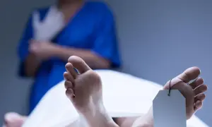 Stopy z metką identyfikacyjną, widoczne plamy opadowe. W tle osoba w niebieskim fartuchu zakłada rękawiczki.