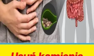 Skuteczne leki na kamienie żółciowe: Jak uniknąć bolesnej operacji