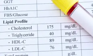 Wynik lipidogramu: cholesterol całkowity 175 mg/dL, HDL 89 mg/dL, LDL 76 mg/dL. Wartość cholesterolu nie-HDL jest kluczowa dla oceny ryzyka sercowo-naczyniowego.