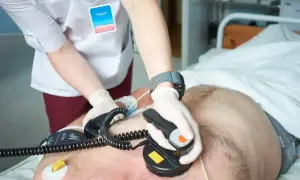 Lekarz wykonuje kardiowersję pacjentowi, przykładając elektrody defibrylatora do klatki piersiowej.