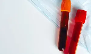 Dwie probówki z krwią na tle maseczki medycznej. Badanie krwi, np. egfr co to, może pomóc w diagnostyce.