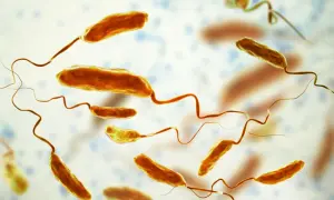 Mikroskopijny obraz bakterii cholery (Vibrio cholerae) z charakterystycznymi wiciami.