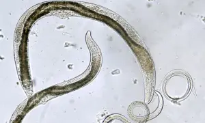 Mikroskopijny obraz nicieni, prawdopodobnie owsików, na jasnym tle.
