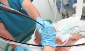 Lekarz w niebieskich rękawiczkach wykonuje bronchoskopię, wprowadzając endoskop do dróg oddechowych pacjenta.