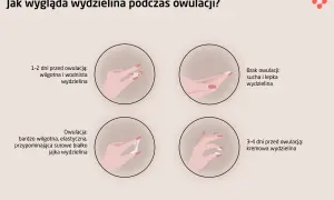 Ilustracja pokazuje zmiany wydzieliny w cyklu, w tym objawy owulacji: wodnista, kremowa i elastyczna, jak białko jaja.