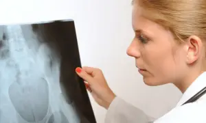 Lekarka analizuje zdjęcie RTG miednicy, szukając oznak kostniak.