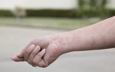 Różowe plamki na skórze ręki mogą być jednym z objawów białaczki.