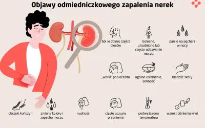 Ilustracja przedstawia objawy zapalenia nerek: ból pleców, problemy z oddawaniem moczu, obrzęki, nudności, gorączkę i inne.