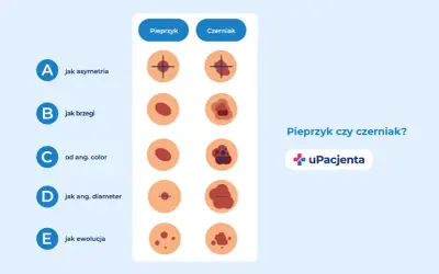 Porównanie znamion: łagodne pieprzyki vs. potencjalnie groźne czerniaki. Ilustracje pokazują różnice w asymetrii, brzegach, kolorze, średnicy i ewolucji.