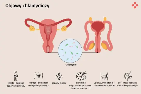 Ilustracja przedstawia układ rozrodczy kobiety i mężczyzny, z powiększeniem ukazującym bakterie chlamydii. Wymienione są objawy chlamydiozy: ból przy oddawaniu moczu, obrzęk narządów płciowych, ropa w moczu, plamienia, upławy i ból podczas stosunku.