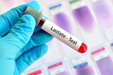 Ręka w niebieskiej rękawiczce trzyma probówkę z krwią do testu na mleczan.