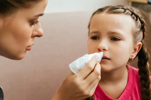 Mama delikatnie przykłada chusteczkę do nosa córki, która ma krew z nosa.