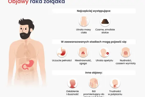 Objawy raka żołądka: utrata masy ciała, czarne stolce, uczucie pełności, niestrawność, zgaga, utrata apetytu, nudności, wymioty, osłabienie, ból pleców, trudności w połykaniu.