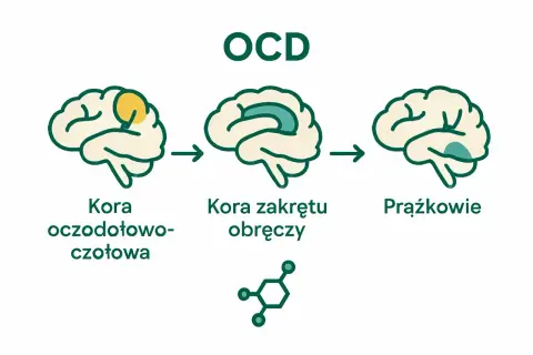 Ilustracja pokazuje mózg z zaznaczonymi obszarami: kora oczodołowo-czołowa, kora zakrętu obręczy i prążkowie. Sugeruje to powiązanie tych obszarów z objawami OCD.