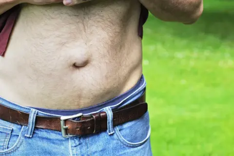 Widoczne objawy przepukliny pępkowej u mężczyzny. Wypukłość w okolicy pępka, widoczna pod podwiniętą koszulką i nad paskiem.