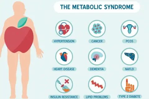 Ilustracja przedstawia sylwetkę człowieka z jabłkiem w brzuchu, symbolizującym zespół metaboliczny. Obok ikony wskazują na choroby: nadciśnienie, raka, PCOS, choroby serca, demencję, NAFLD, insulinooporność, problemy z lipidami i cukrzycę typu 2.