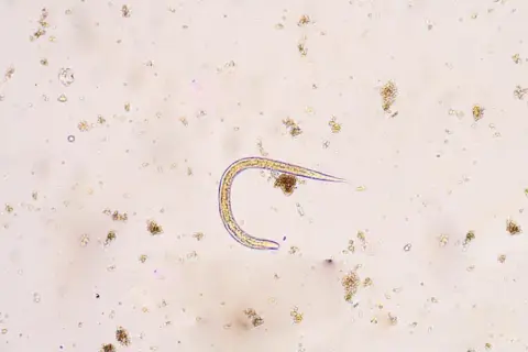 Mikroskopowy obraz nicienia w próbce, otoczony drobnymi cząstkami.