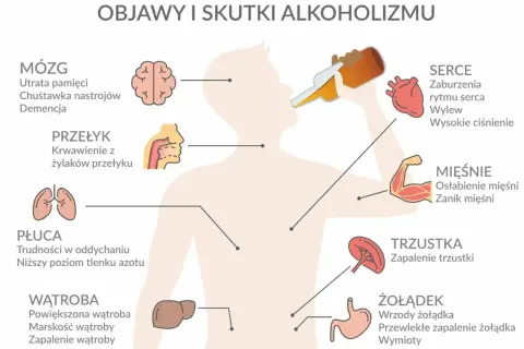 Ilustracja przedstawia sylwetkę człowieka z zaznaczonymi organami i ich schorzeniami spowodowanymi przez alkoholizm.