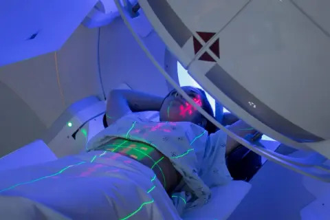 Pacjentka leży pod aparatem do radioterapii, na jej ciele widoczne są zielone i czerwone linie naprowadzające.