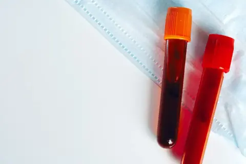 Dwie probówki z krwią na tle maseczki medycznej. Badanie krwi, np. egfr co to, może pomóc w diagnostyce.