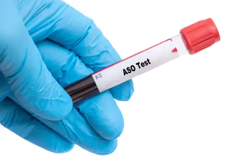 Ręka w niebieskiej rękawiczce trzyma probówkę z napisem "ASO Test".