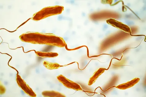 Mikroskopijny obraz bakterii cholery (Vibrio cholerae) z charakterystycznymi wiciami.