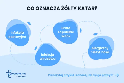 Grafika przedstawia schemat przyczyn żółtego kataru: infekcja bakteryjna, wirusowa, ostre zapalenie zatok, alergiczny nieżyt nosa.