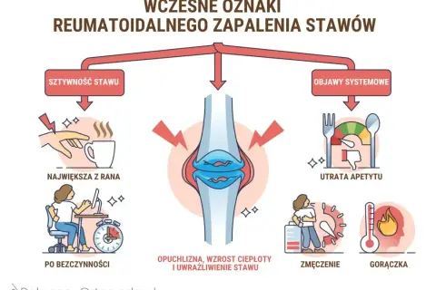 Wczesne objawy reumatoidalnego zapalenia stawów: sztywność, opuchlizna, utrata apetytu, zmęczenie, gorączka.