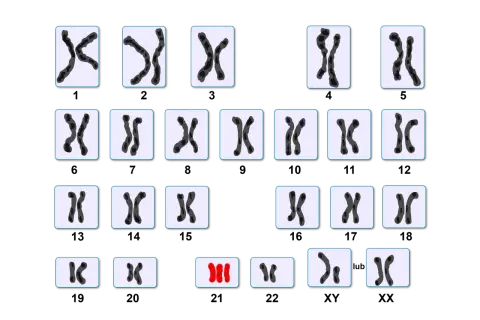 Zestawienie różnych par chromosomów, w tym jedna nieprawidłowa triada.