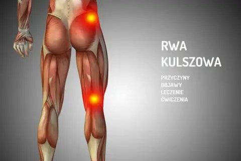 Rwa kulszowa a ból kolana: objawy, które musisz znać