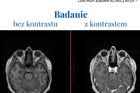 Alkohol po kontraście: czy można pić i jakie są zagrożenia?