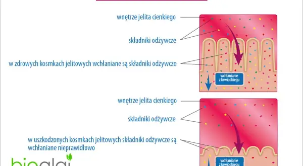 Objawy zaburzeń wchłaniania – jak rozpoznać i co może je powodować?