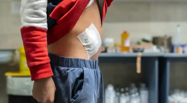 Dziecko z opatrunkiem na brzuchu po operacji.